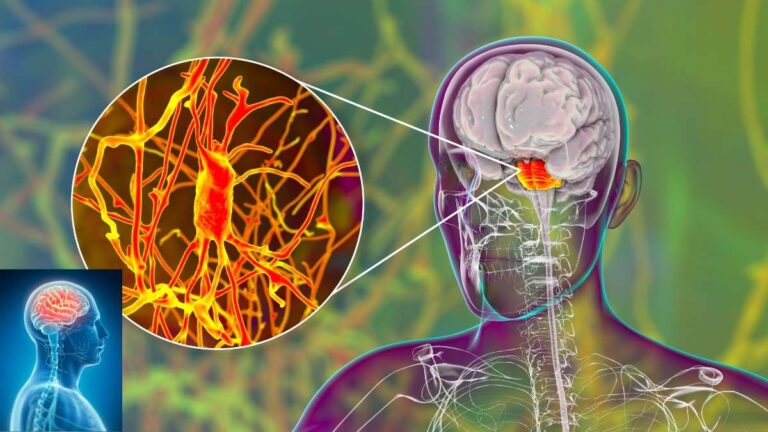 doctorhub360.com Neurological Diseases